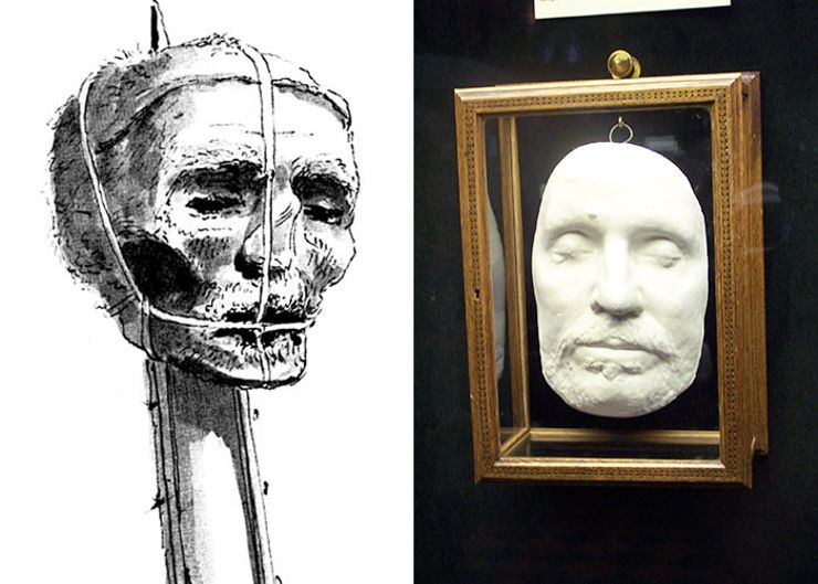 missing body parts