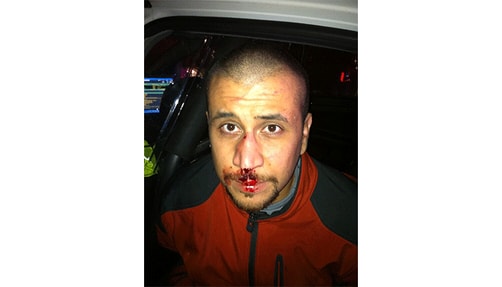 Photo of George Zimmerman on night of incident.